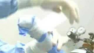 Dog ACL Surgery [upl. by Angle]