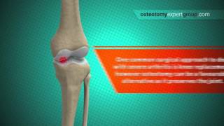 OMT Somatic Dysfunction Cervical Spine [upl. by Oluas544]