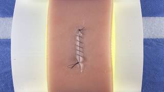 Simple Continuous Running Baseball Suture [upl. by Ihcelek]