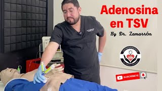 TAQUICARDIA SUPRAVENTRICULAR  ¿Cómo administrar la ADENOSINA [upl. by Siravaj]