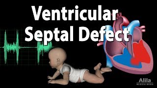 Atrial Fibrillation On Echocardiogram [upl. by Melton523]