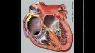 Supraventricular Arrhythmias by C LaGrasta  OPENPediatrics [upl. by Atipul]