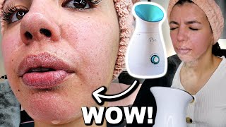 I Tested The Best FACIAL STEAMER On Amazon [upl. by Ahseik]