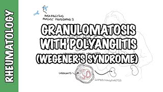 INFLAMMATION Part 9 Chronic Inflammation  GRANULOMATOUS INFLAMMATION [upl. by Ecyac]