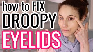 How to FIX DROOPY HOODED EYELIDS Dr Dray [upl. by Elmo134]