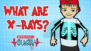 How do XRays Work  Broken Bones  Operation Ouch [upl. by Lorilyn786]