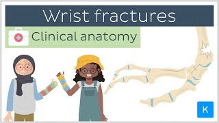 Forearm fractures Wrist fractures  Clinical Anatomy  Kenhub [upl. by Nauqel]