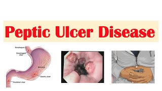 Small intestine 1 Structure  Gastrointestinal system physiology  NCLEXRN  Khan Academy [upl. by Araas]