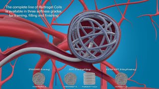 MicroVention Coil Procedural and Clinical Outcome Animation [upl. by Trebleht]