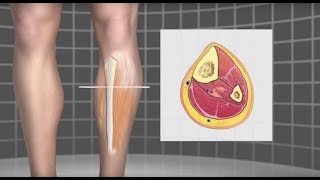 What is Compartment Syndrome  TheNurseNinja [upl. by Aihppa]