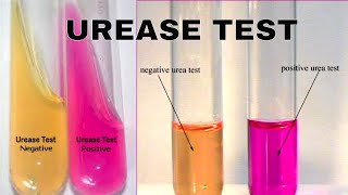 Urea Hydrolysis Urease Test [upl. by Primo16]