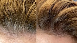 GRAY HAIR ROOT TOUCH UP IN JUST 10 MINUTES  Schwarzkopf Igora Color10 Tutorial  Daniella Benita [upl. by Horter]