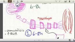 Regeneracion nerviosa snp Parte 2 Neuroapraxia Axonotmesis Neurotmesis Histologia [upl. by Brittany]