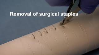 Applying SteriStripsButterfly stitches to a small wound [upl. by Season]