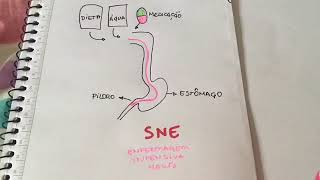 Diferença entre SNE e SNG [upl. by Zosema934]