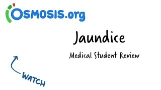 Jaundice  Clinical Presentation [upl. by Llehsor573]