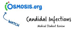 Candidal Infections Osmosis Study Video [upl. by Luas]