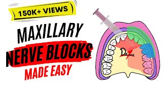 Maxillary Nerve Block Anesthesia For Dental Procedures [upl. by Robyn]