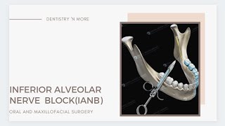 INFERIOR ALVEOLAR NERVE BLOCK [upl. by Ecile]