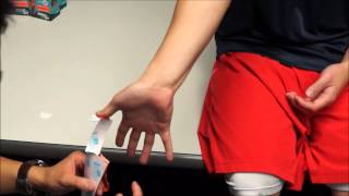 MuscleAidTape Pronator Teres Syndrome [upl. by Azeria121]