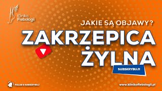 ZAKRZEPICA ŻYLNA  jakie są jej objawy [upl. by Husha513]