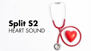 Fixed Split S2  Heart Sounds  MEDZCOOL [upl. by Borchert72]