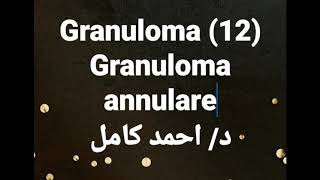 12 Granuloma annulare [upl. by Kerri]