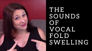 What VOCAL FOLD SWELLING Sounds Like [upl. by Bathsheeb]