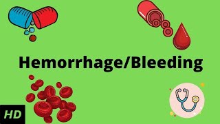 Hemorrhage bleeding Causes Signs and Symptoms Diagnosis and Treatment [upl. by Eidnac]