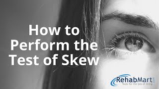 How to Perform the Test of Skew for Vertigo [upl. by Hamid]