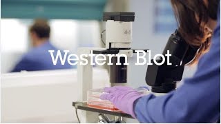 Western blot protocol video [upl. by Juta]