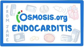 Clinicians Corner Endocarditis [upl. by Asirram]