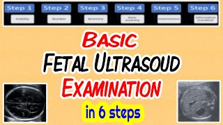 Basic Fetal Ultrasound Examination [upl. by Boyd682]