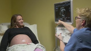 Ultrasounds during pregnancy [upl. by Notgnirra531]