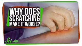 Why Does Scratching Make Itching Worse [upl. by Aneekat726]