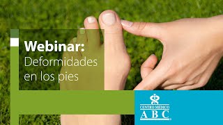 Webinar deformidades en los pies juanetes y dedos en garra [upl. by Kiele]