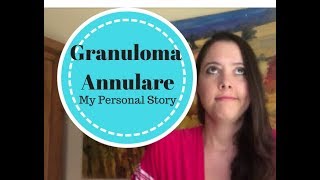 Granuloma Annulare My Story [upl. by Ortrud]