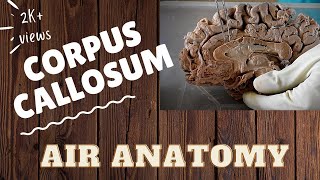 Corpus callosum  Air Anatomy [upl. by Akcirderf214]