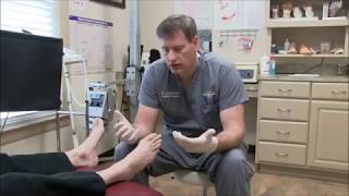 Treating Toenail Fungus with Lamisil [upl. by Wilterdink]