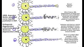 Wallerian degeneration regeneration process of nerve fiberaxon cut and progressive response [upl. by Ardnac]