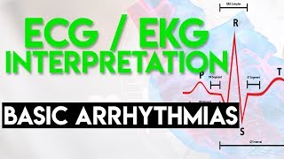 Basic Arrhythmias  Sinus Brady Tachy Premature Beats  ECG EKG Interpretation Part 3 [upl. by Ahsaetal704]