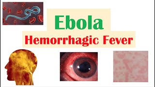 Overview of Ebola  Hemorrhagic Fever Causes Pathophysiology Symptoms Diagnosis Treatment [upl. by Huttan]