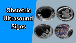 Obstetric Ultrasound Signs [upl. by Neema]