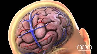 Concussion and Bleeding On The Brain [upl. by Accebor]