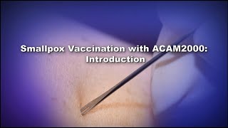 Chapter 1 Smallpox Vaccination with ACAM2000 Introduction [upl. by Cassandre815]