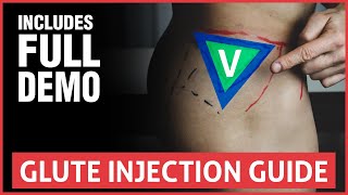 Direct Injection vs Port Injection [upl. by Eremaj]