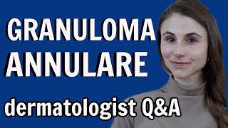 Granulomatosis with Polyangiitis Wegener’s granulomatosis  Symptoms Diagnosis Treatment [upl. by Arlina]