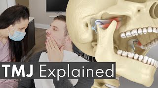 TMJ Explained  Jaw Pain Causes amp Symptoms [upl. by Campman254]