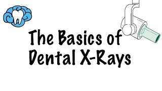 How to Read Dental XRays [upl. by Barbour]