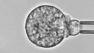 Human neutrophil versus Coccidioides cause of Valley fever Chemotaxis adhesion and phagocytosis [upl. by Novikoff832]